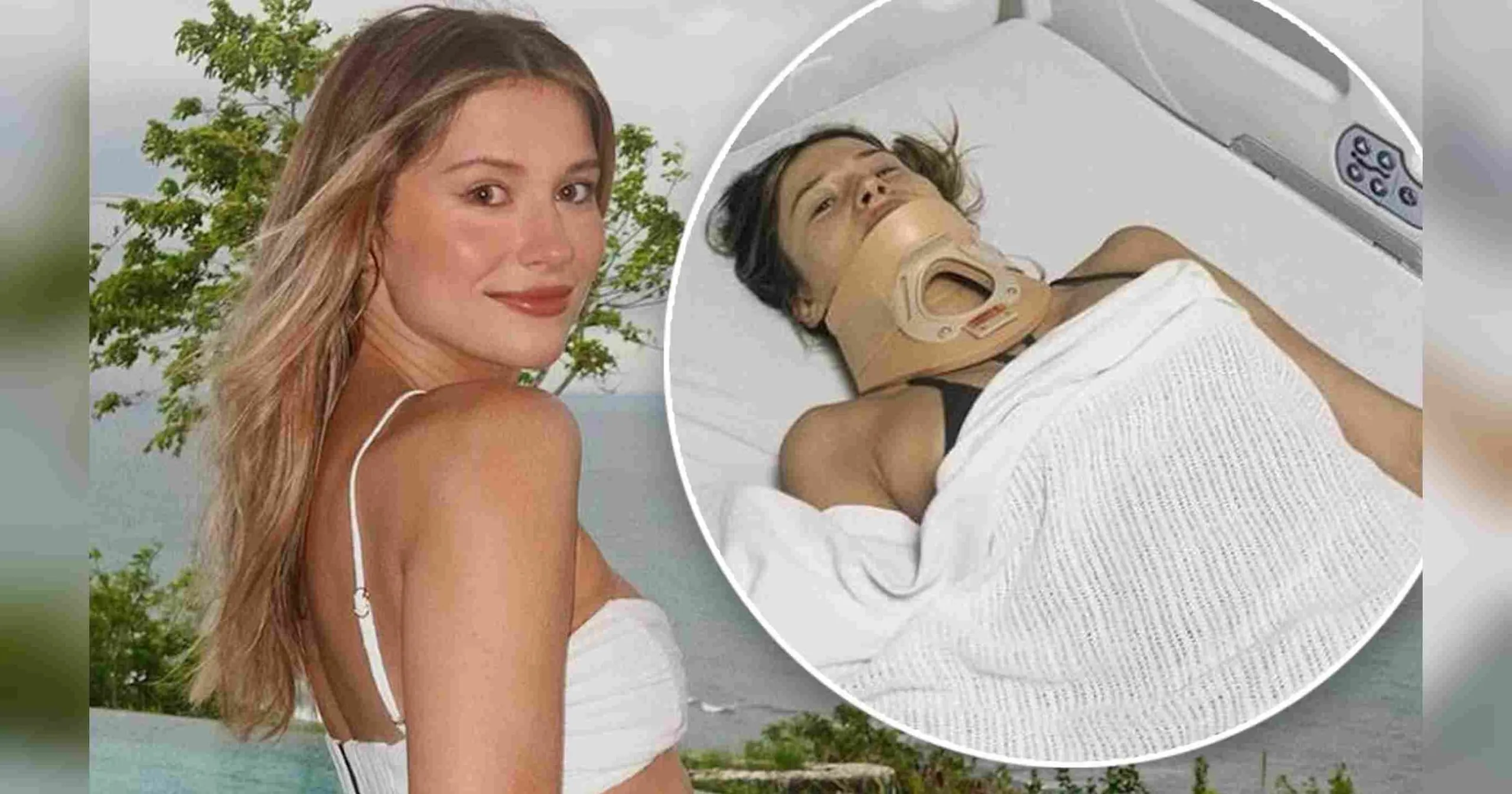 Mantan Miss Universe Australia Alami Cedera Serius Akibat Kecelakaan