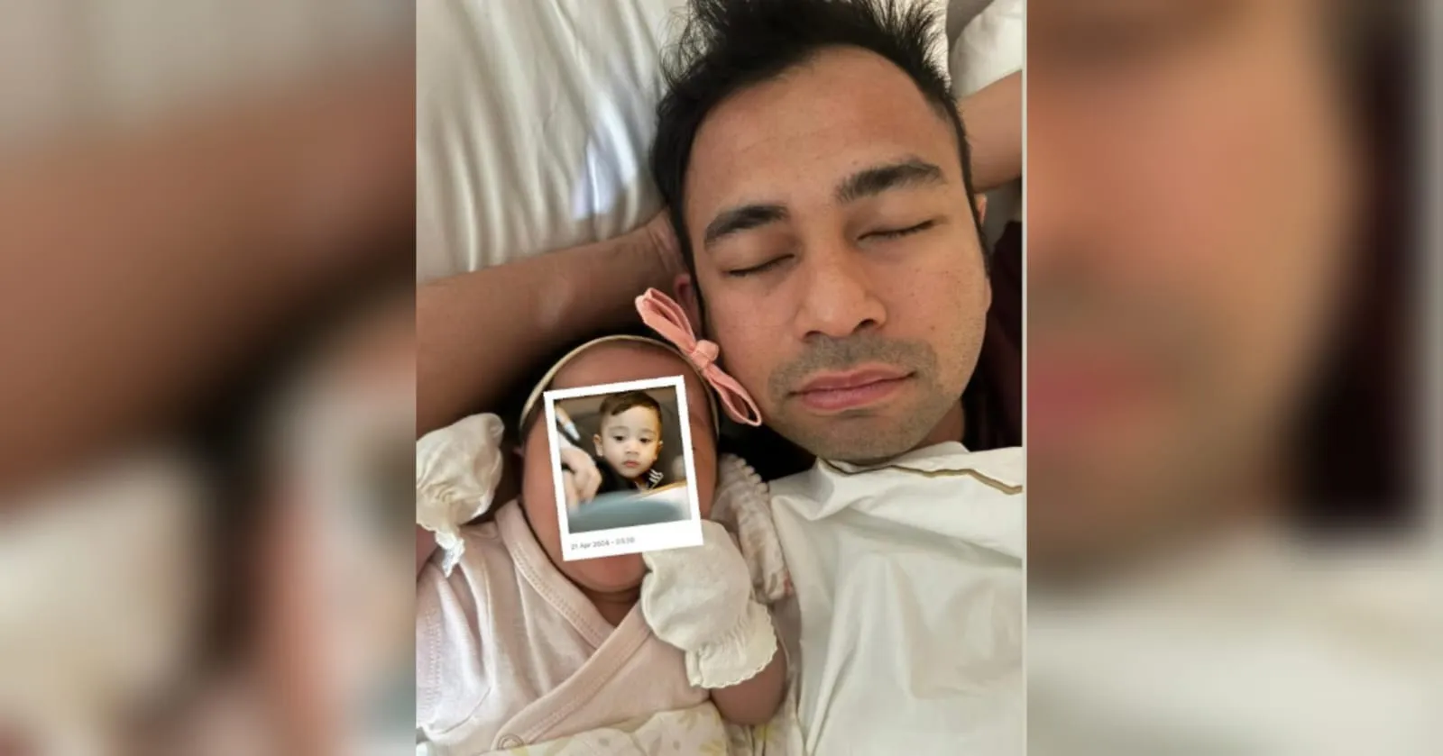Bayi Lily Mirip Cipung? Yuk, Intip Fotonya