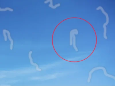 Ilustrasi Eye Floaters. (Foto: KlikDokter)