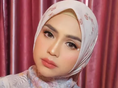 PASCA CERAI: Ria Ricis hendak operasi kantung mata. Foto: Dok. Instagram @riaricis1795