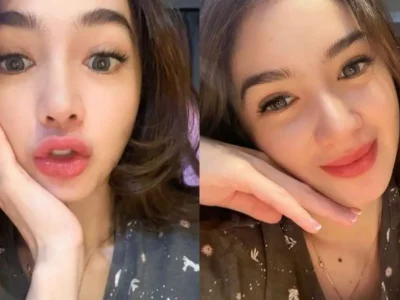 Penampilan terbaru Angel Karamoy pasca operasi plastik. Foto : Instagram/realangelkaramoy