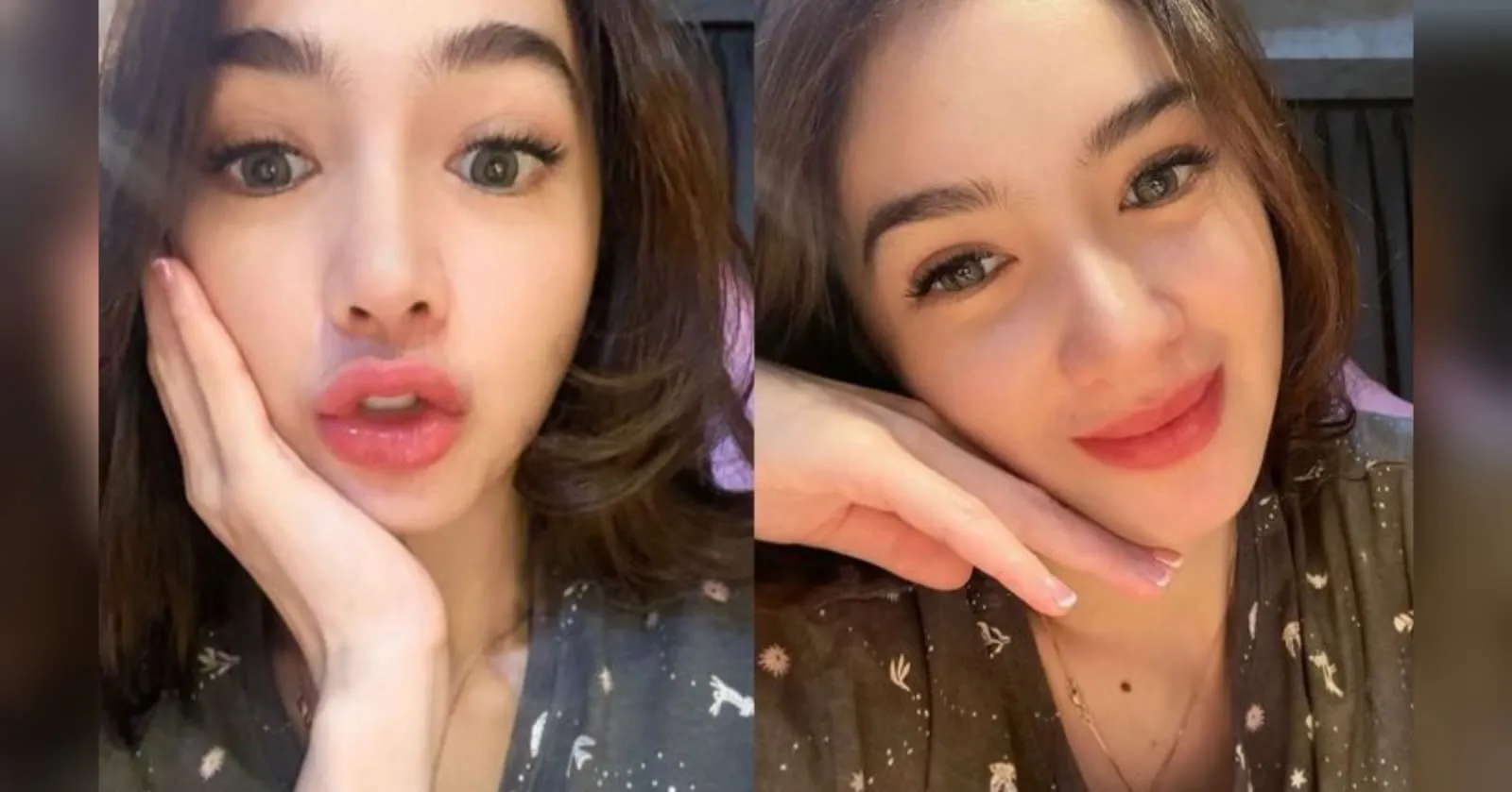Potret Wajah Cantik Angel Karamoy Usai Oplas