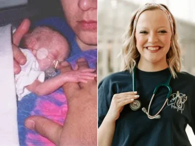 Hayley Good terlahir sebagai bayi prematur 499 gram, kini tumbuh besar jadi perawat. (Foto: Dok. People)