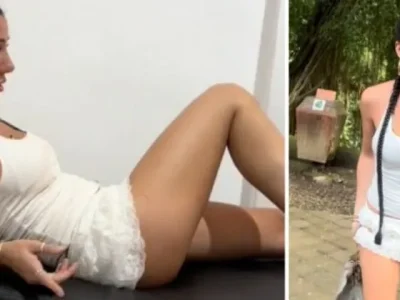 WNA asal Austaria, Jami Groves, disuntik rabies setelah terkena gigitan monyet di Monkey Forest Ubud. (Foto: Instagram/@jamigroves)