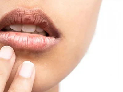 Bibir hitam pun bisa tampil cantik dan bersinar. (Foto: Freepik)