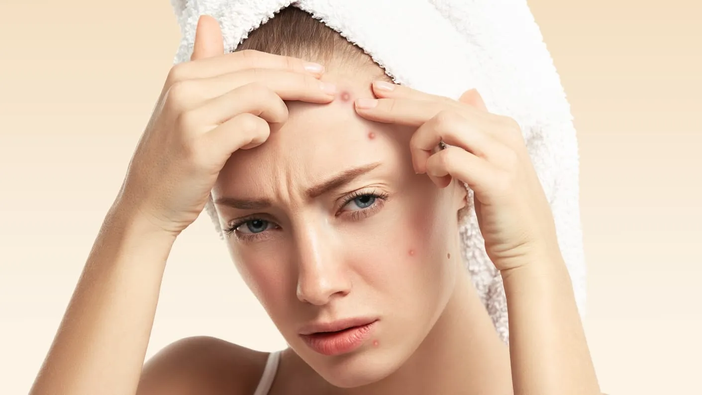 Pimple Patch, Betul Efektif Atasi Jerawat?