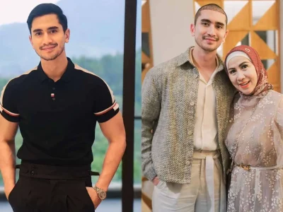 Verrell Bramasta tampil beda dengan kepala plontos usai transplantasi rambut di Turki (Foto: instagram/bramastavrl)