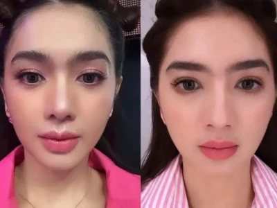 Potret wajah Angel Karamoy usai oplas (After sebelah kiri, Before yang kanan). Foto : Instagram/realangelkaramoy