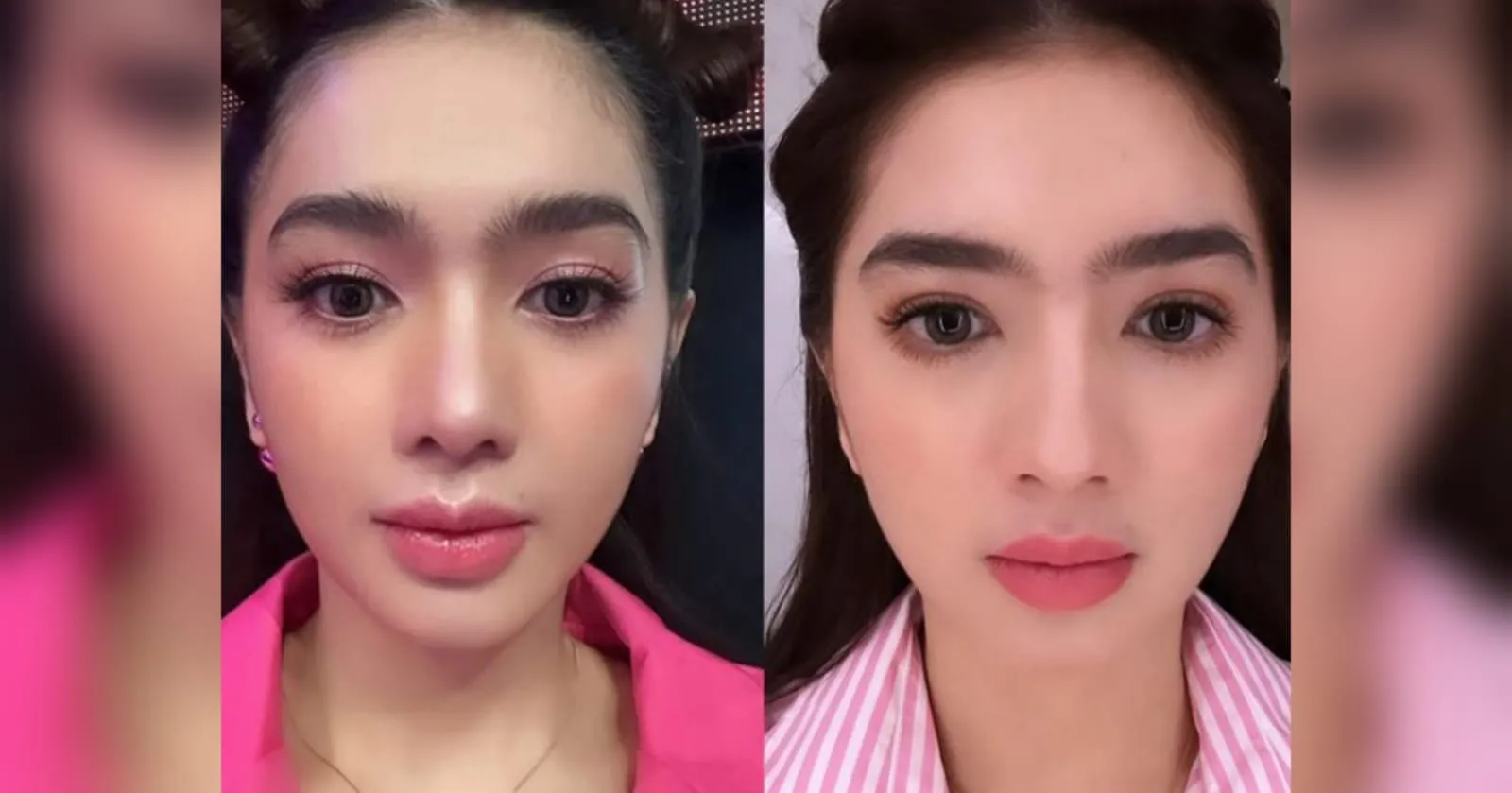 Angel Karamoy Pamer Wajah Before After Oplas, Disebut Lebih Cantik Dulu