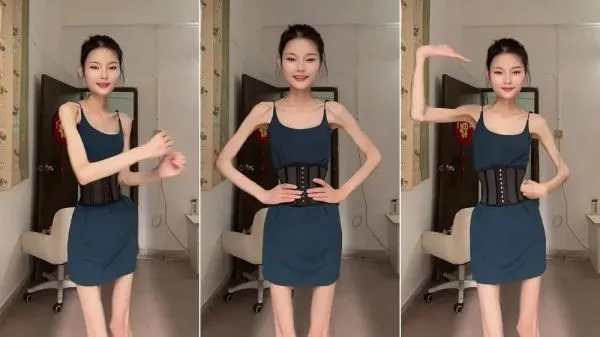 Punya Berat Badan 25 Kg, Wanita di China Ini Ingin Kurus Lagi