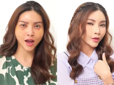Sarwendah akhirnya muncul di TV setelah operasi plastik di Korea Selatan (Foto: instagram/sarwendah29)