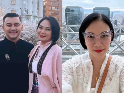 Dian Nitami lakukan operasi plastik sebagai bentuk self-reward (Foto: instagram/bu_deedee)