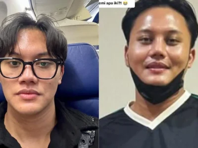 Rizky Febian sebelum dan sesudah diduga operasi plastik. Foto: Dok. Kolase Instagram @rizkyfbian, TikTok @puputdeka_17