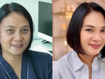 Dian Nitami tampil lebih muda dan segar setelah face lift di Korea (Foto: instagram/bu_deedee)