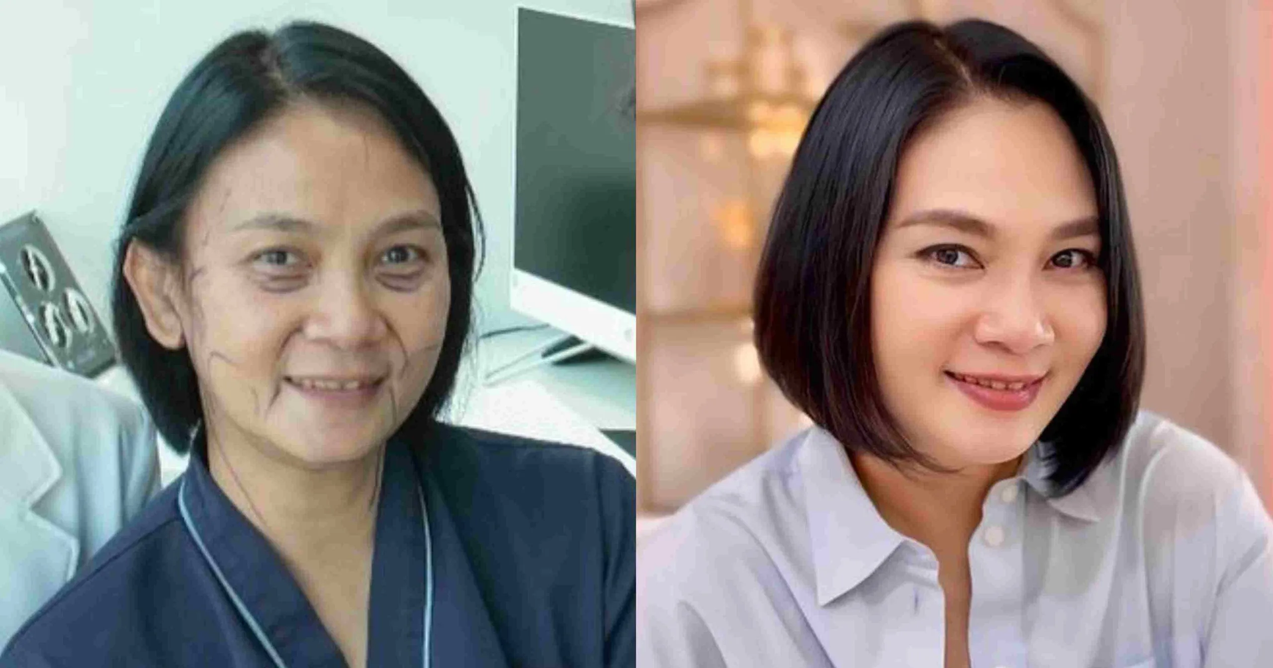 Dian Nitami Puas Dengan ‘Wajah Barunya’ Usai Oplas
