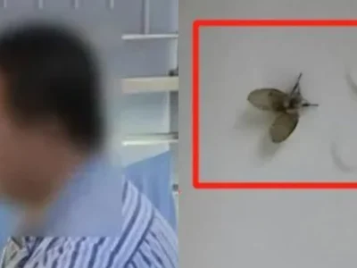 Bola mata pria di China harus diangkat karena infeksi virus lalat limbah. Foto: Dok. SCMP