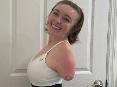 Wanita Tanpa Lengan, Ahli Masak dengan Kakinya (Foto: instagram/emrrowley)