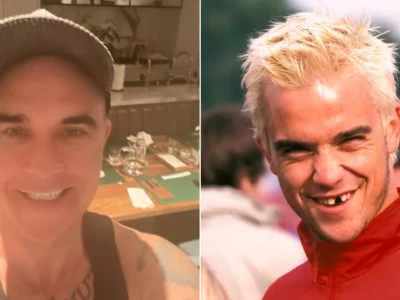 Robbie Williams pamer gigi baru. (Foto: Instagram/robbiewilliams)