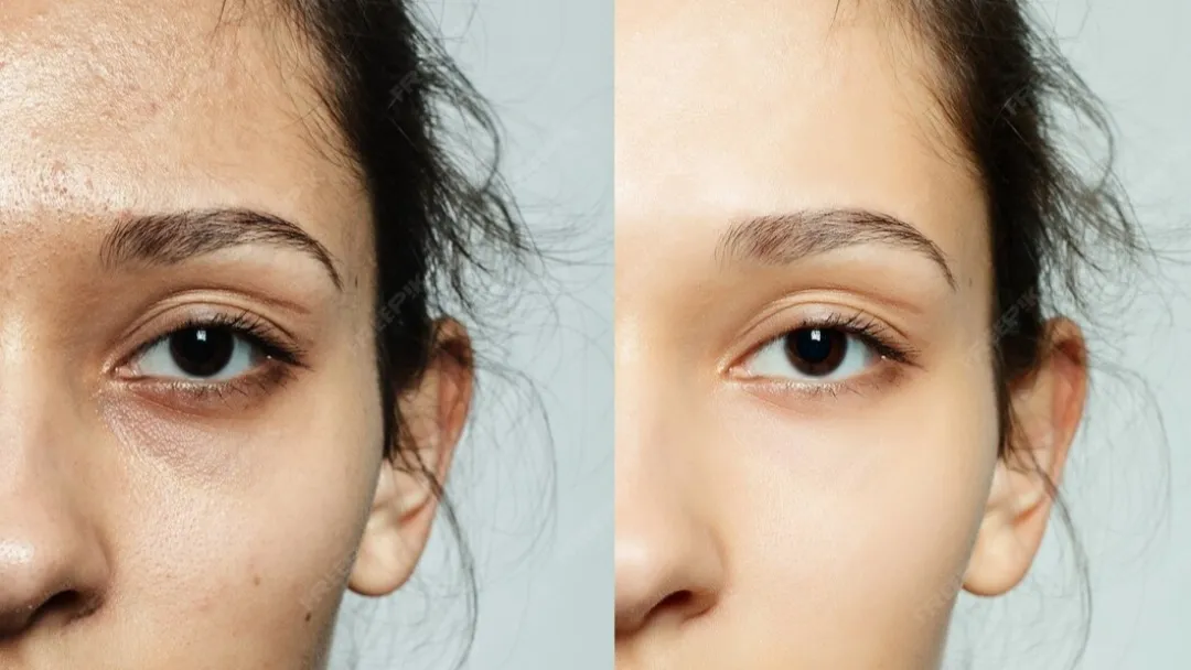 Tips Jitu Makeup untuk Sembunyikan Mata Panda