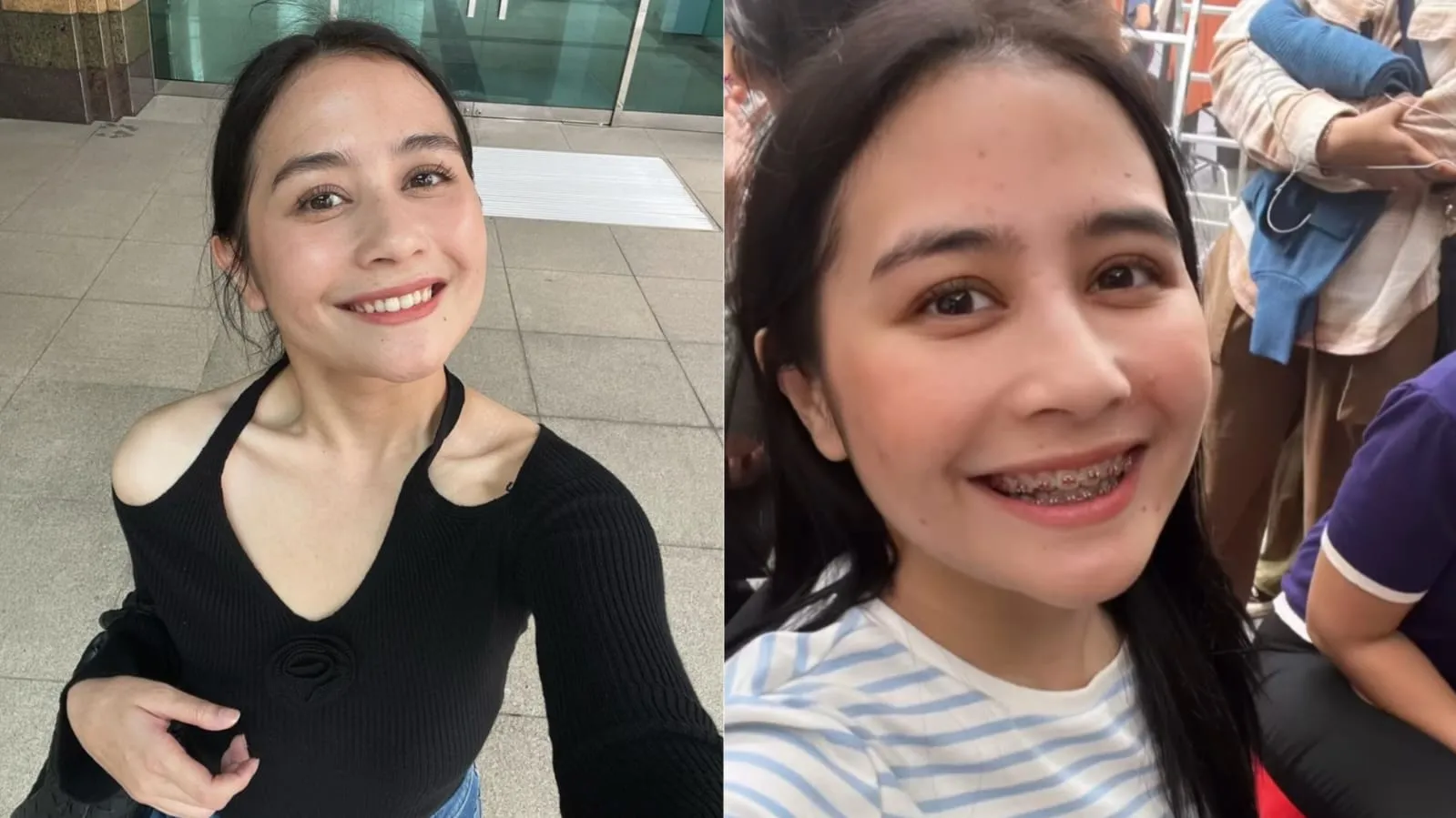 Prilly Latuconsina Bagikan Pengalaman Pakai Behel untuk Film Baru