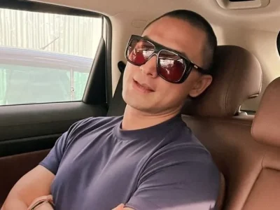 PASCA OPLAS: Indra Bruggman pakai kacamata tutupi mata cekung. Foto: Dok. Instagram @indrabruggman