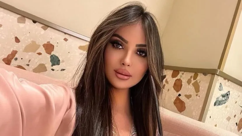 Ingin Mirip Kim Kardashian, Model Brazil Ini Rela Oplas 30 Kali