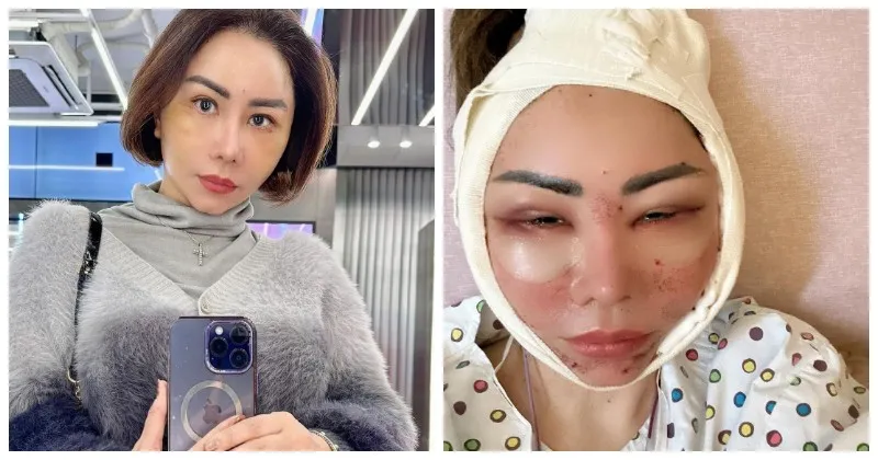 Potret Terbaru Femmy Permatasari Pasca Oplas Sebanyak 6 Kali