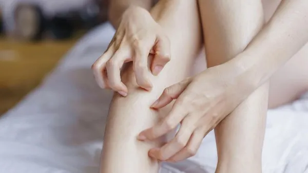 Awas Keliru, Ini Perbedaan Gatal Biasa dan Gatal Diabetes