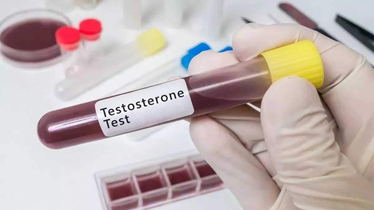 Manfaat Hormon Testosteron Bagi Kesehatan Pria dan Wanita