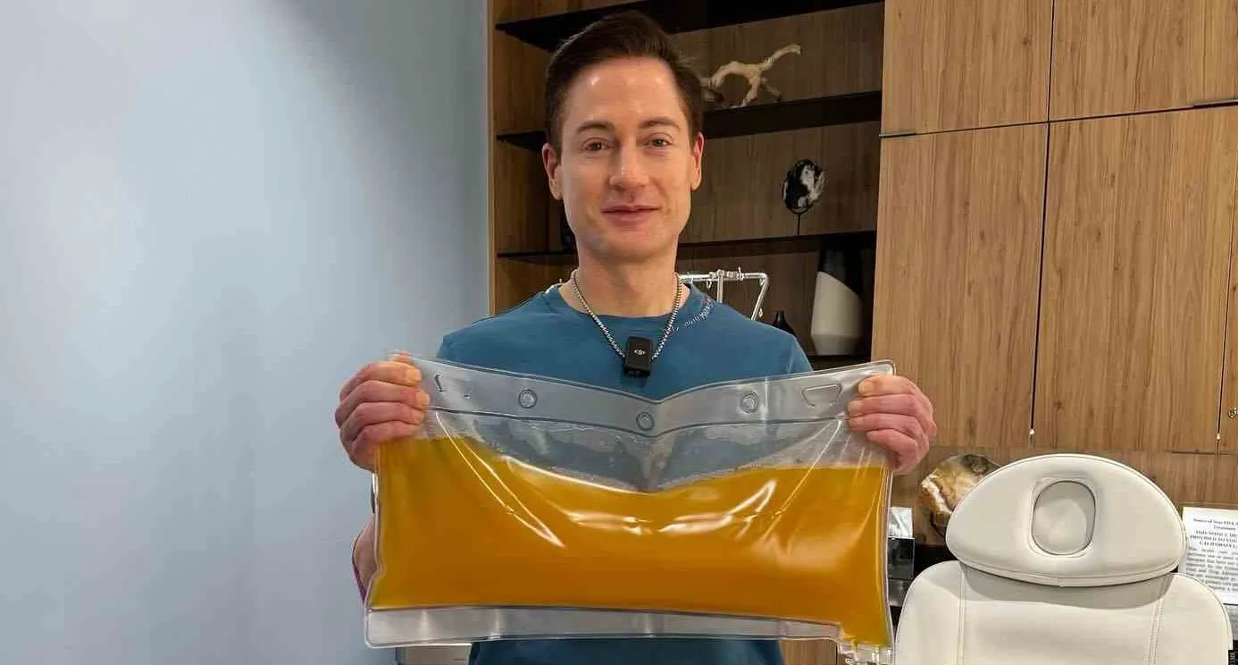 Miliarder Bryan Johnson Ganti Plasma Darah Demi Awet Muda