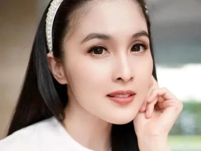 Sandra Dewi mengidap penyakit kulit, Rosacea. Foto : Instagram/sandradewi88