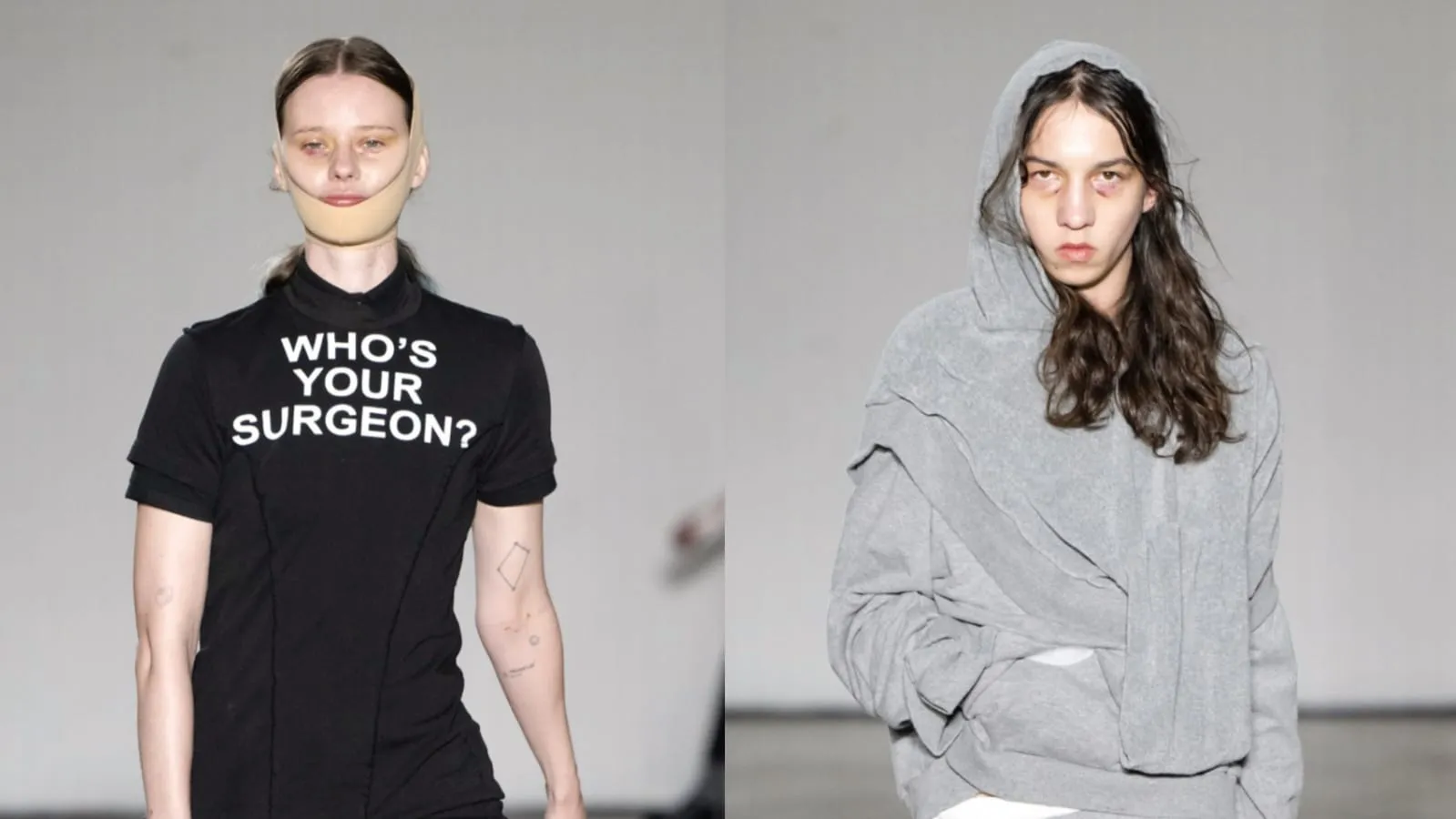 Gaya Model ‘Oplas’ Melenggang di Runway London Fashion Week