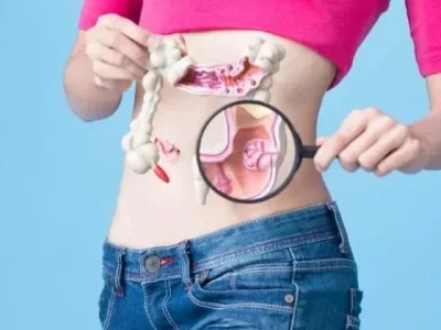 ILUSTRASI : Kanker usus besar rupanya dipicu beberapa makanan. Foto : Istimewa