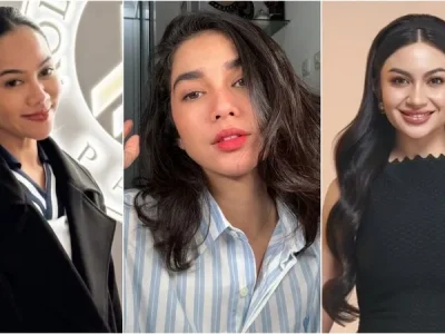 Artis Indonesia yang memiliki bekas luka (Foto: Instagram/yurayunita, ussypratama, arieltatum)