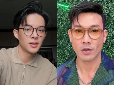 Artis Indonesia yang baru melakukan operasi plastik (Foto: kolase dari Instagram/rey_mbayang dan Instagram/sumargodenny)