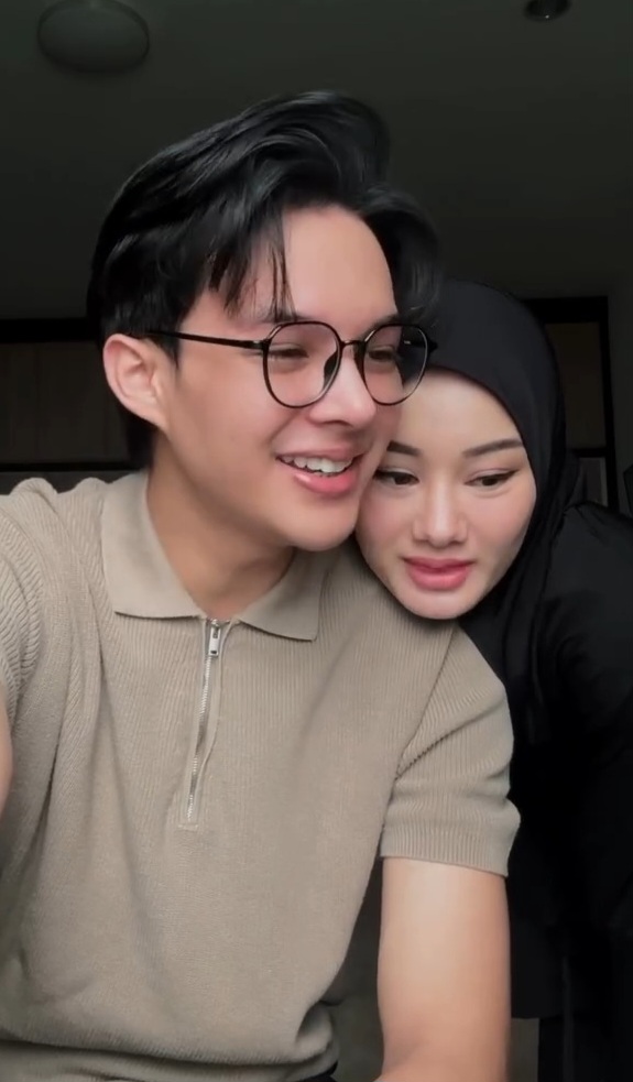 Bentuk hidung Rey Mbayang setelah oplas (Foto: Instagram/rey_mbayang)
