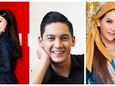 Artis Tanah Air yang Pernah Idap Bell’s palsy. Foto : Instagram