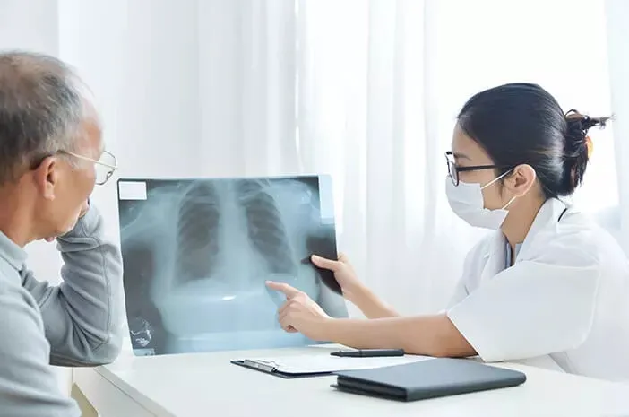 Pentingnya Skrining dan Deteksi Dini Untuk Tekan Angka Kematian Penderita Kanker Paru