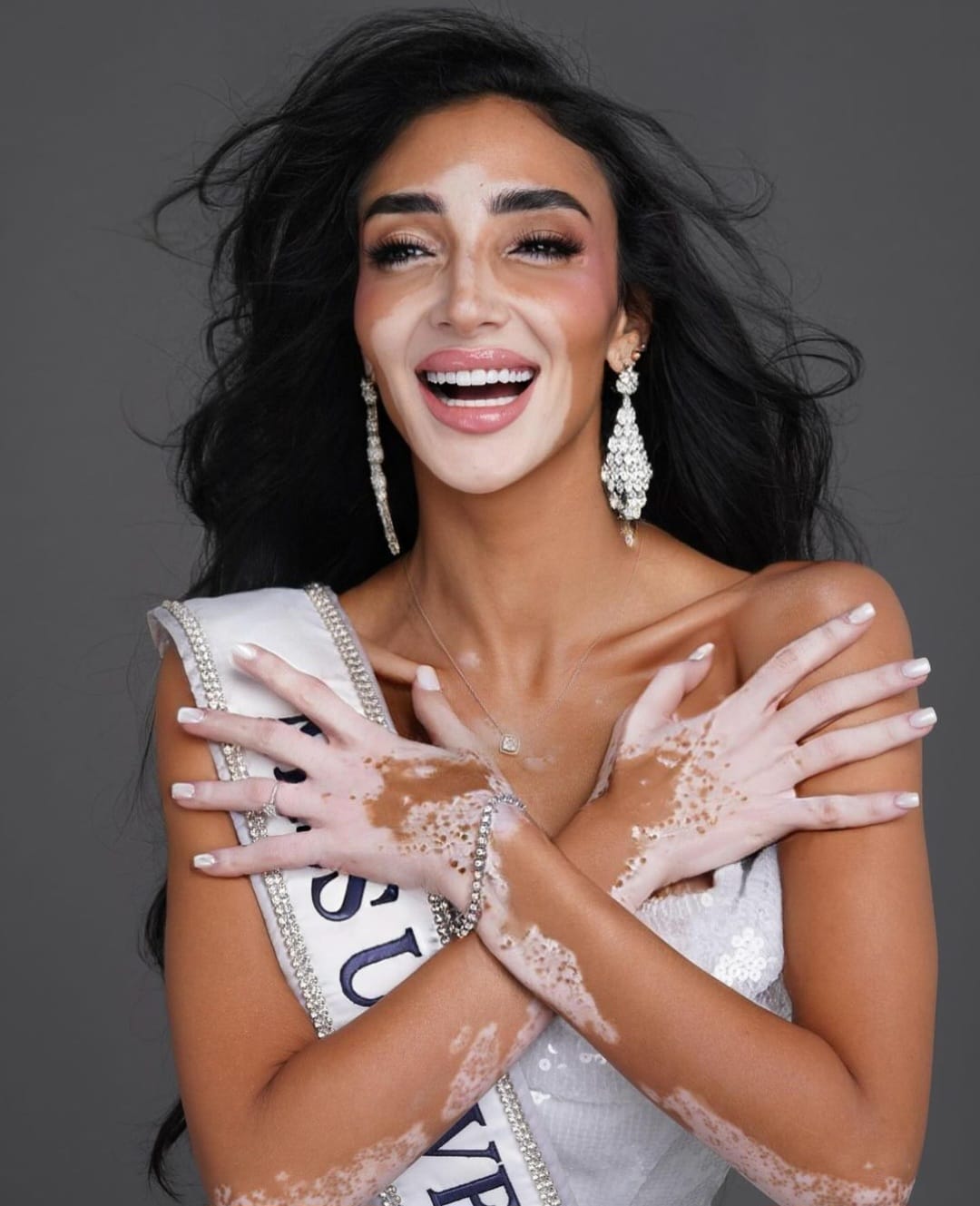 Logina Salah, kontestan Miss Universe pertama dengan kelainan kulit. Foto: Dok. Instagram @missuniverse.egypt