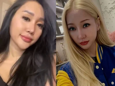 Perubahan drastis Lucinta Luna sebelum dan sesudah oplas (Foto: kolase Instagram/lucintaluna_manjalita)