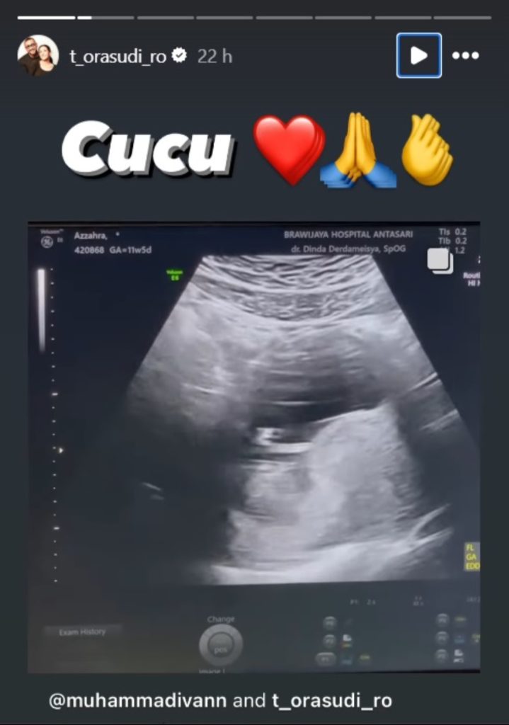 Foto USG cucu pertama (Foto: Instagram/t_orasudi_o)