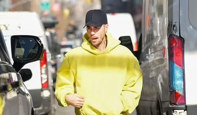 Mata Makin Cekung, Kondisi Justin Bieber Dikhawatirkan Penggemar