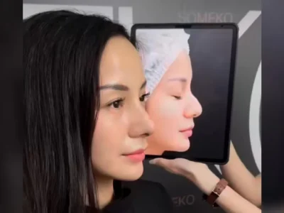 Perbandingan Kirana Larasati sebelum dan sesudah oplas. Foto : Instagram/kiranalarasati