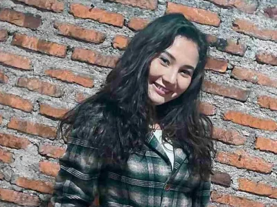Kronologi kecelakaan yang dialami Larasati Nugroho. Foto : Isntagram/larasati_nugrohoo
