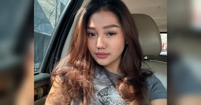 Korban Kekerasan yang Dilakukan Chandrika Chika Alami Patah Tulang