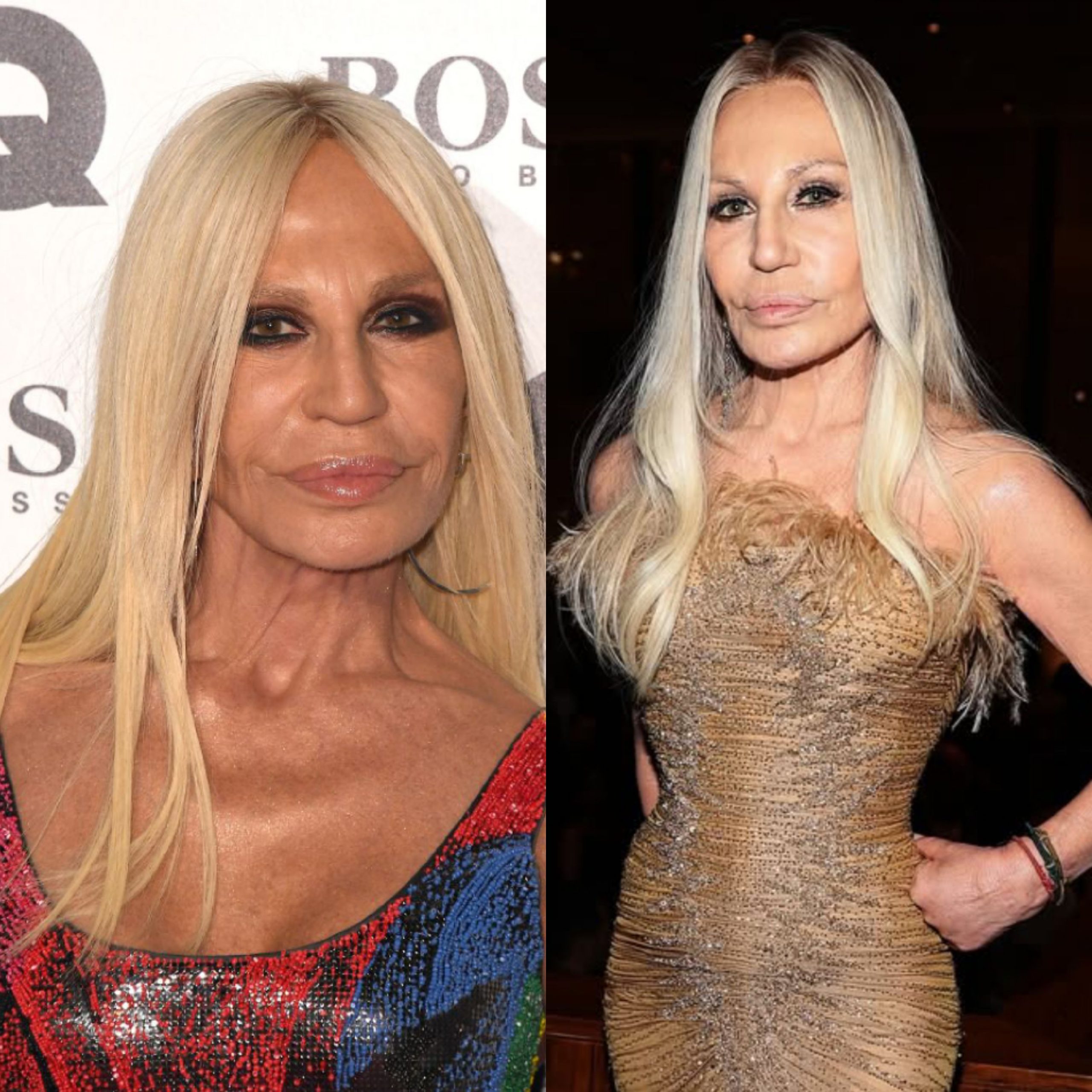 2018-2024 (Foto: Getty dan Instagram/donatella_versace)