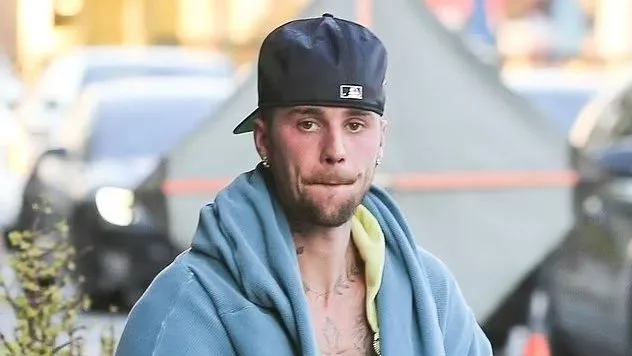 Tampil Acak-acakan, Justin Bieber Kembali Bikin Penggemar Khawatir