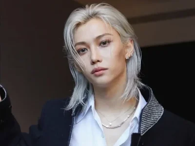 Felix Stray Kids mengalami patah tulang akibat kecelakaan. Foto: Dok. Instagram @yong.lixx