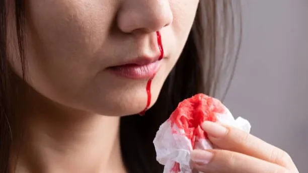 Mengenal Penyakit Langka Von Willebrand, Mirip Hemofilia