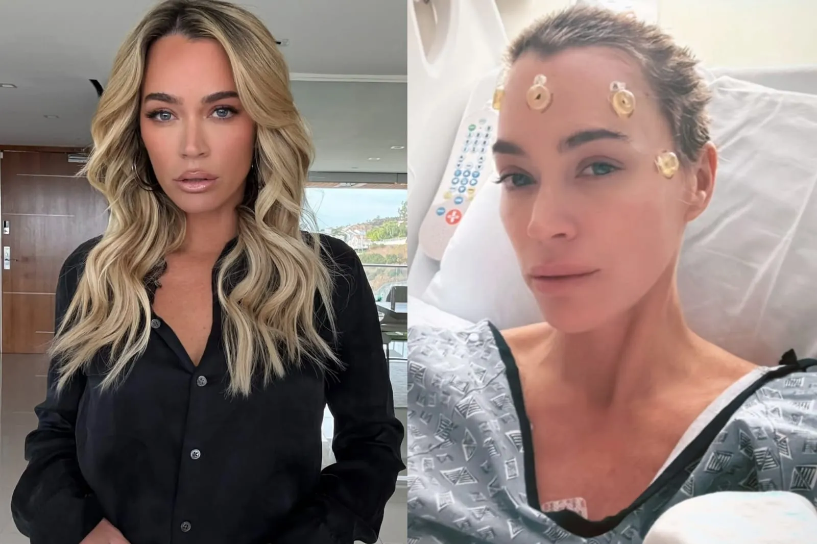 Bintang ‘Real Housewives’, Teddi Mellencamp Idap Tumor Otak